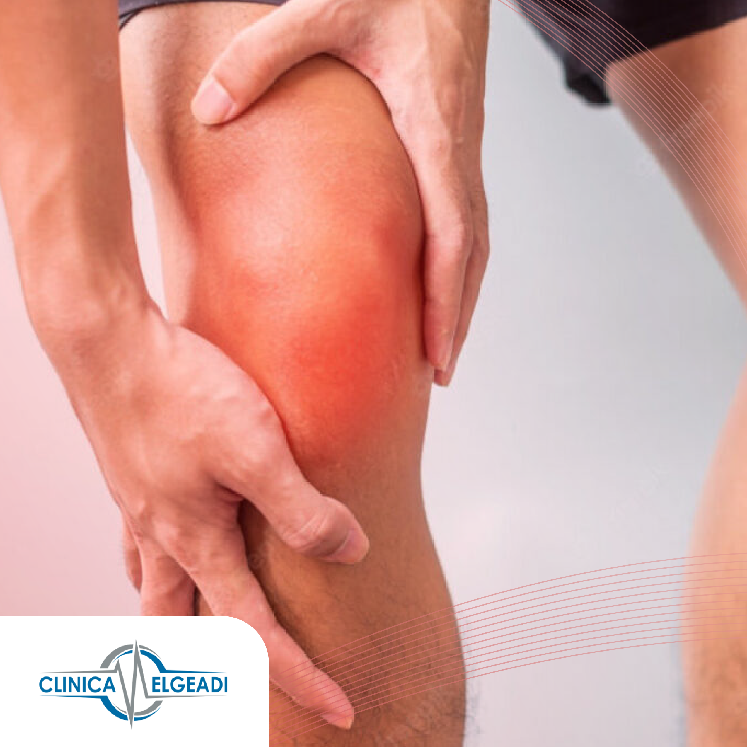 ROTURA DE MENISCO, por CLÍNICA ELGEADI