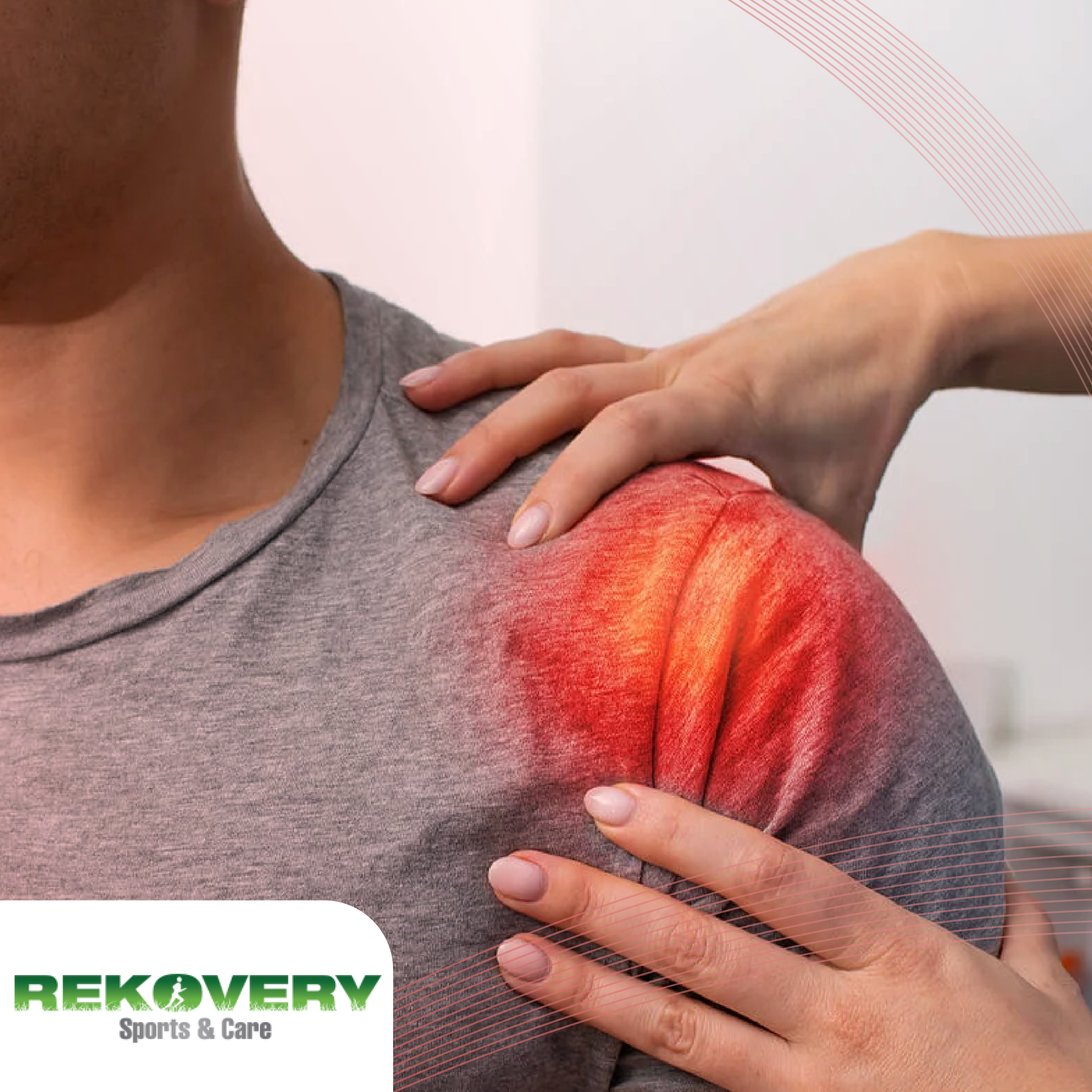 LUXACIÓN Y SUBLUXACIÓN DE HOMBRO, por REKOVERY CLINIC