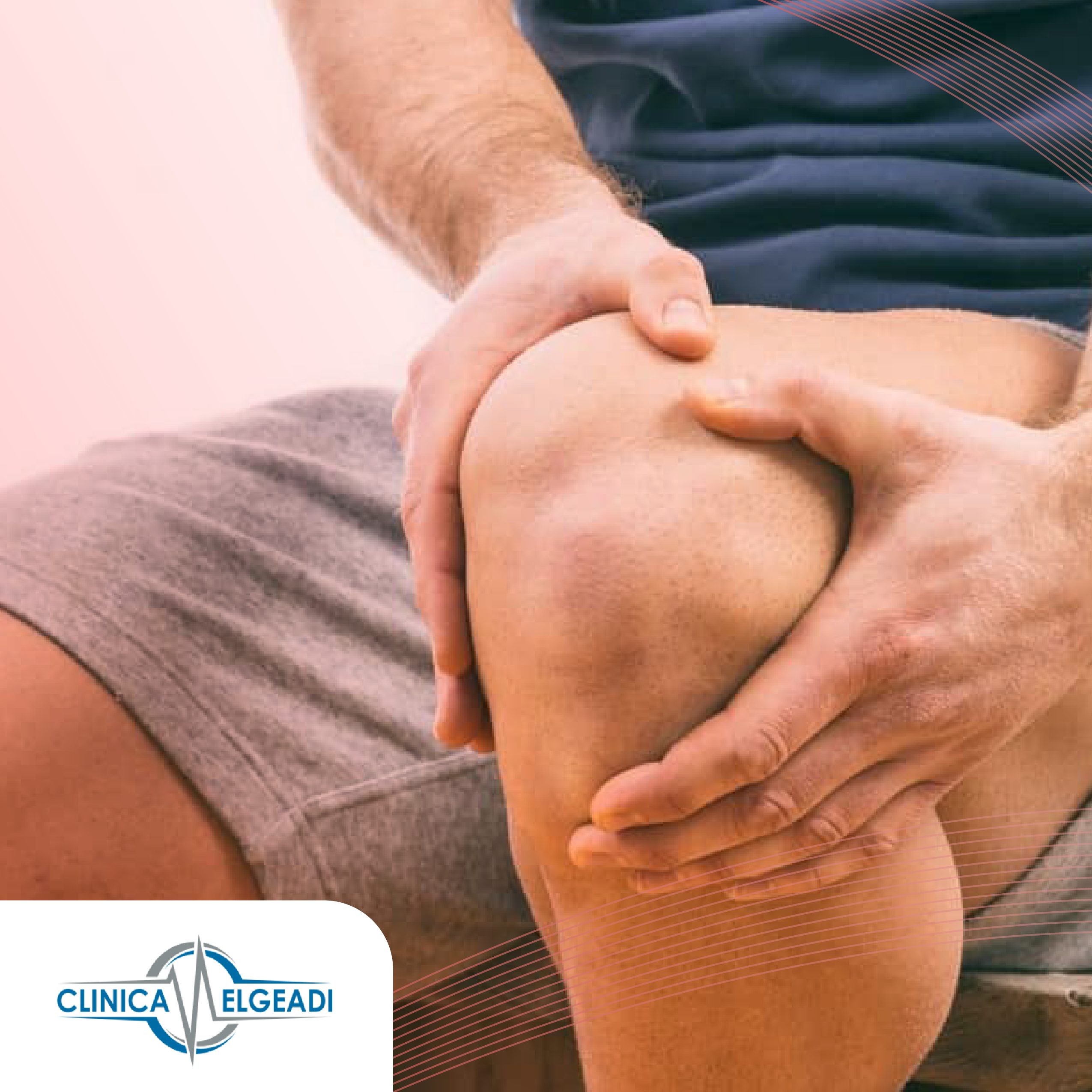 TRATAMIENTO ARTROSCÓPICO Y RECUPERACIÓN DE QUISTES MENISCALES EN LA RODILLA