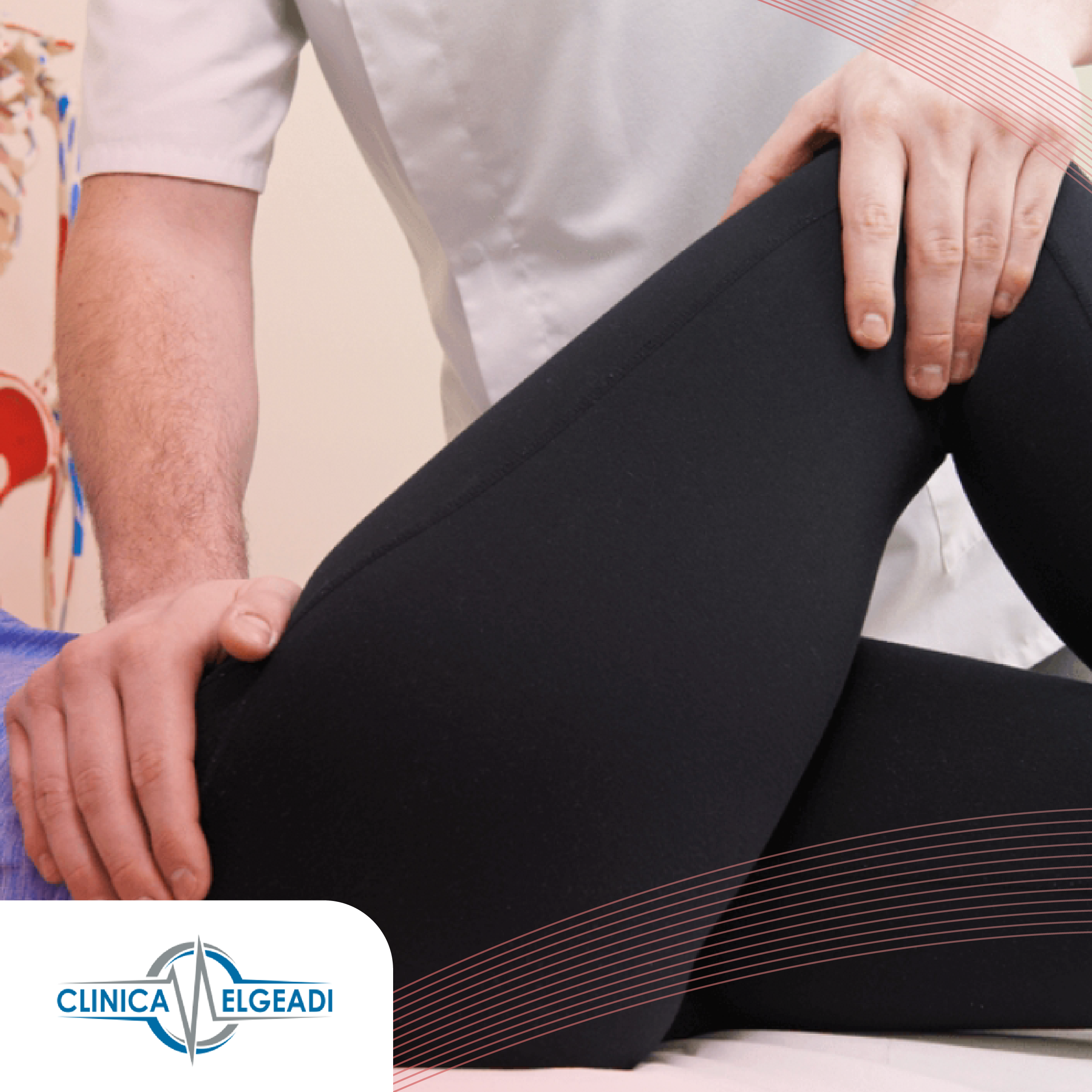 DOLOR DE CADERA EN ADULTOS: EL SÍNDROME DE PINZAMIENTO FEMOROACETABULAR