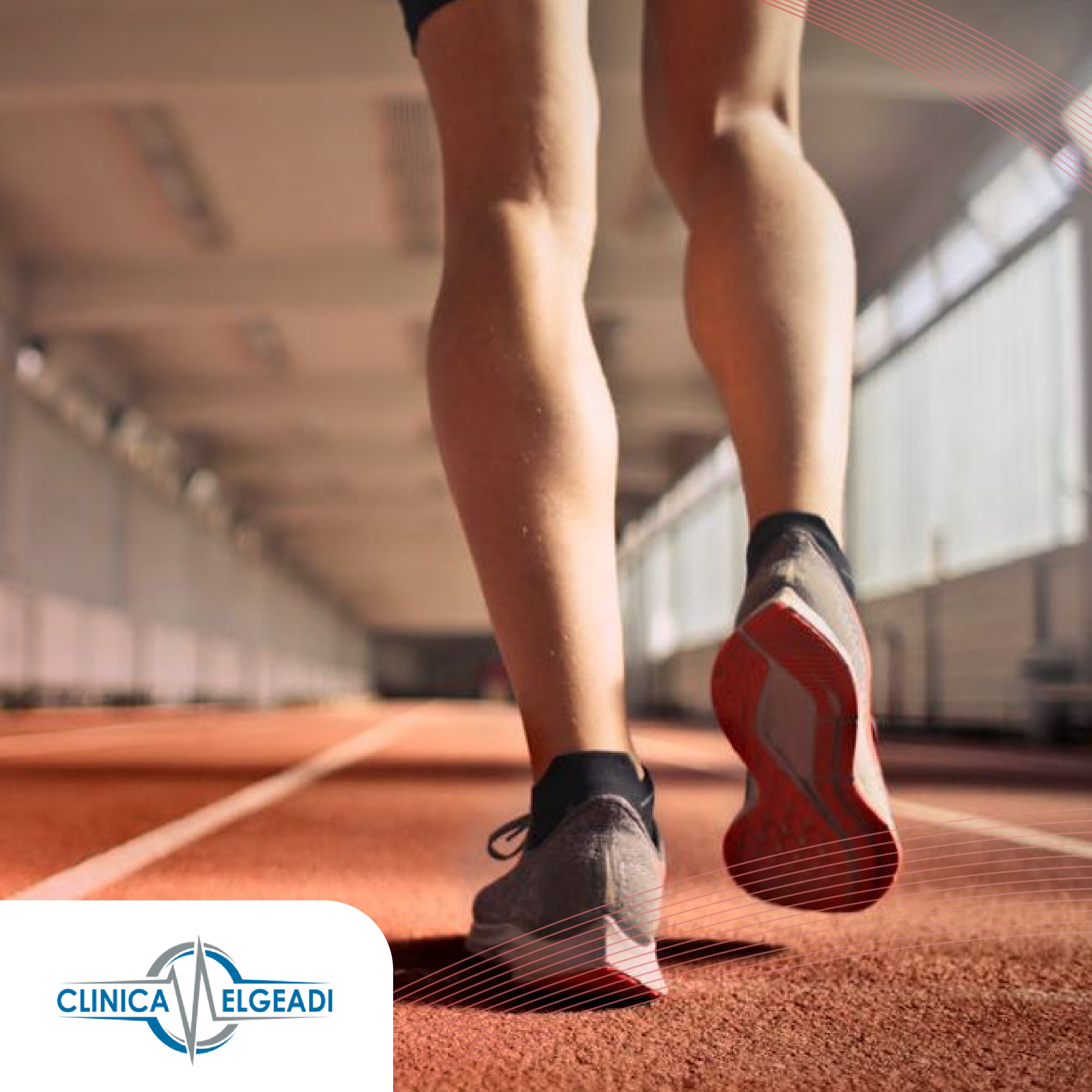 RODILLA DEL CORREDOR: CAUSAS, SÍNTOMAS, DIAGNÓSTICO Y TRATAMIENTO