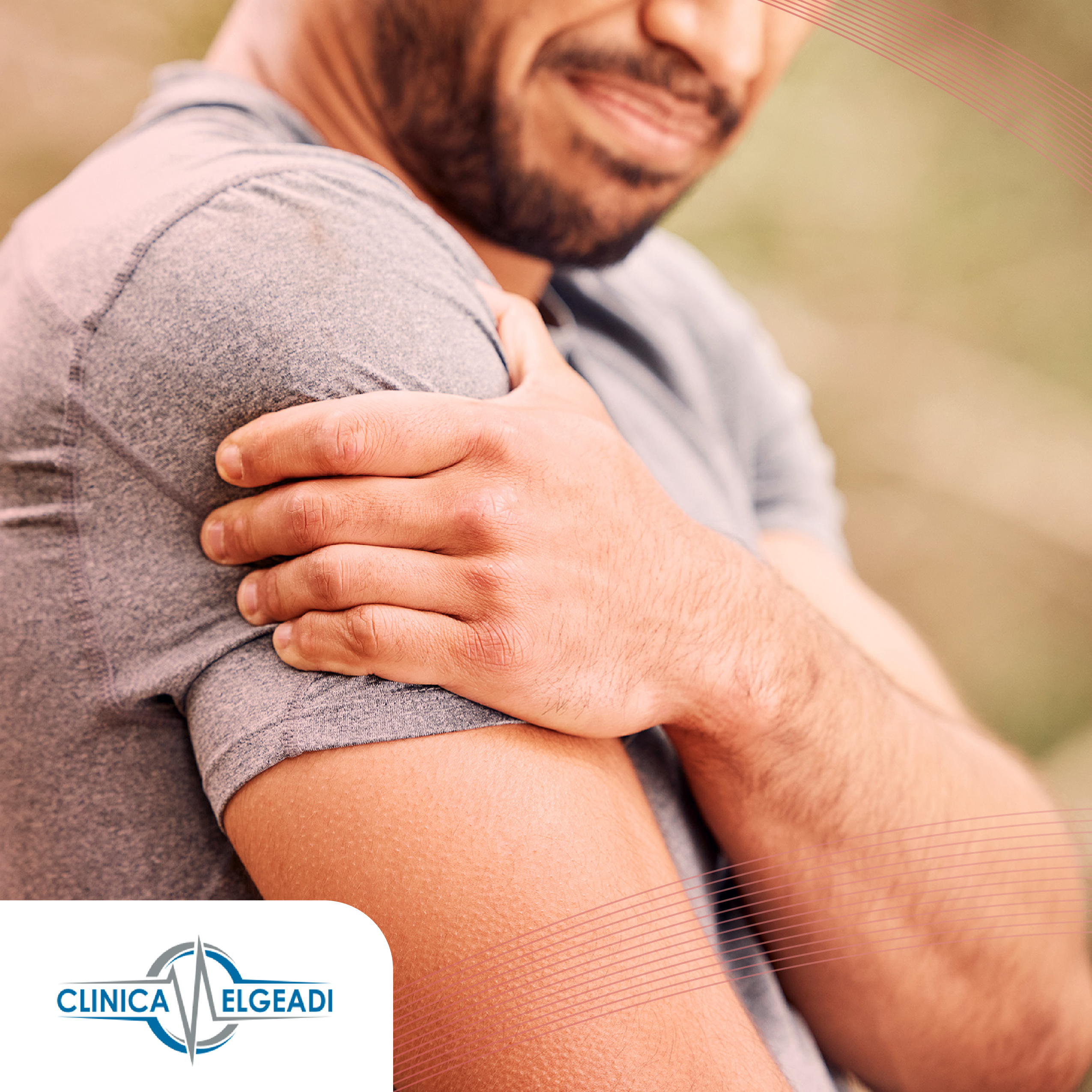 LUXACIÓN ACROMIOCLAVICULAR: CAUSAS, SÍNTOMAS, DIAGNÓSTICO Y ABORDAJE TERAPÉUTICO